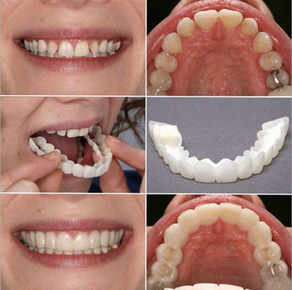 SmileFlex™ Instant Cosmetic Dentures