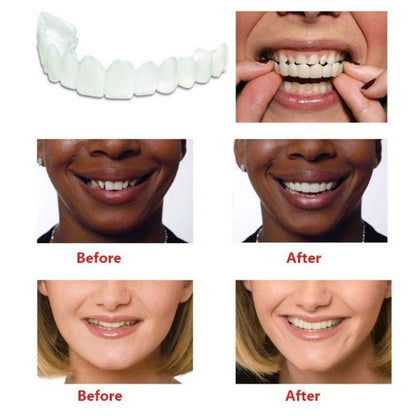 SmileFlex™ Instant Cosmetic Dentures